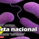 los cdc emiten alerta nacional por bacteria carnivora health
