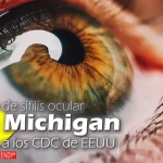 brote de sifilis ocular en michigan alerta a los cdc de eeuu health