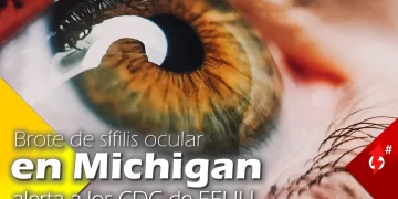 brote de sifilis ocular en michigan alerta a los cdc de eeuu health