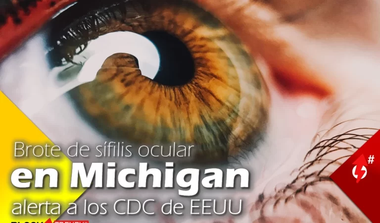 Brote de sífilis ocular en Michigan alerta a los CDC de EEUU